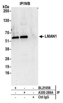 Detection of human LMAN1 by western blot of immunoprecipitates.