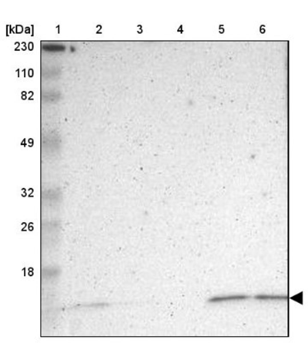 Western Blot: ERH Antibody [NBP1-84976] - Lane 1: Marker [kDa] 230, 110, 82, 49, 32, 26, 18<br/>Lane 2: Human cell line RT-4<br/>Lane 3: Human cell line U-251MG sp<br/>Lane 4: Human plasma (IgG/HSA depleted)<br/>Lane 5: Human liver tissue<br/>Lane 6: Human tonsil tissue