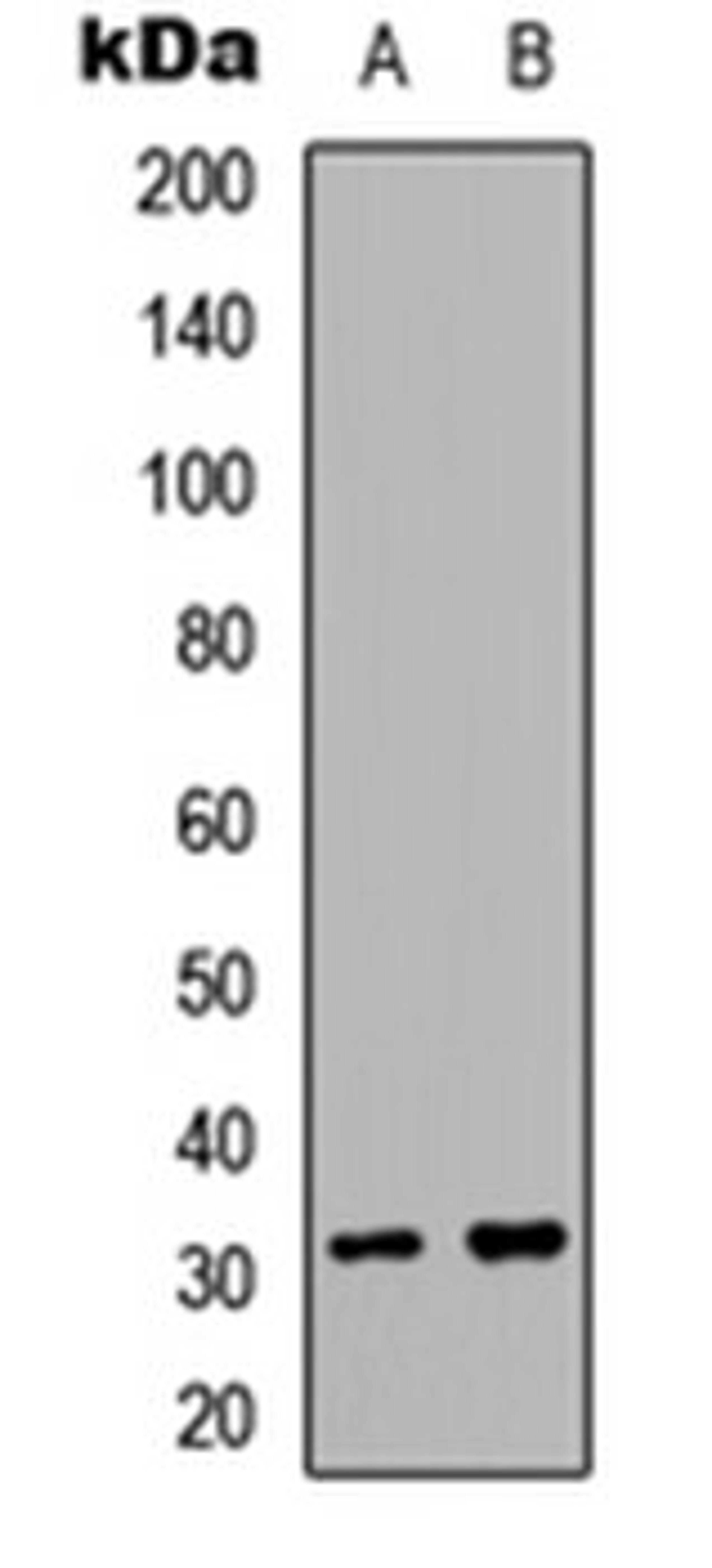 Western blot analysis of A549.MCF7 (Lane 1), PC12 (Lane 2) whole cell lysates using ACER2 antibody