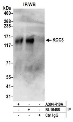 Detection of human KCC3 by western blot of immunoprecipitates.