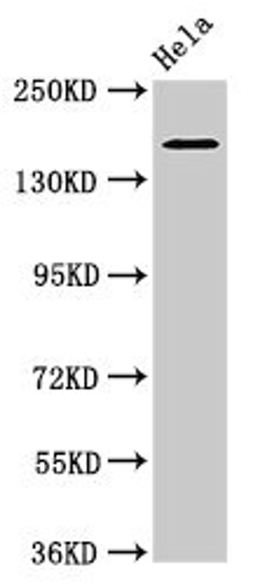 Western Blot. Positive WB detected in: Hela whole cell lysate. All lanes: ROBO1 antibody at 3.2µg/ml. Secondary. Goat polyclonal to rabbit IgG at 1/50000 dilution. Predicted band size: 181, 182, 177, 176, 170 kDa. Observed band size: 181 kDa