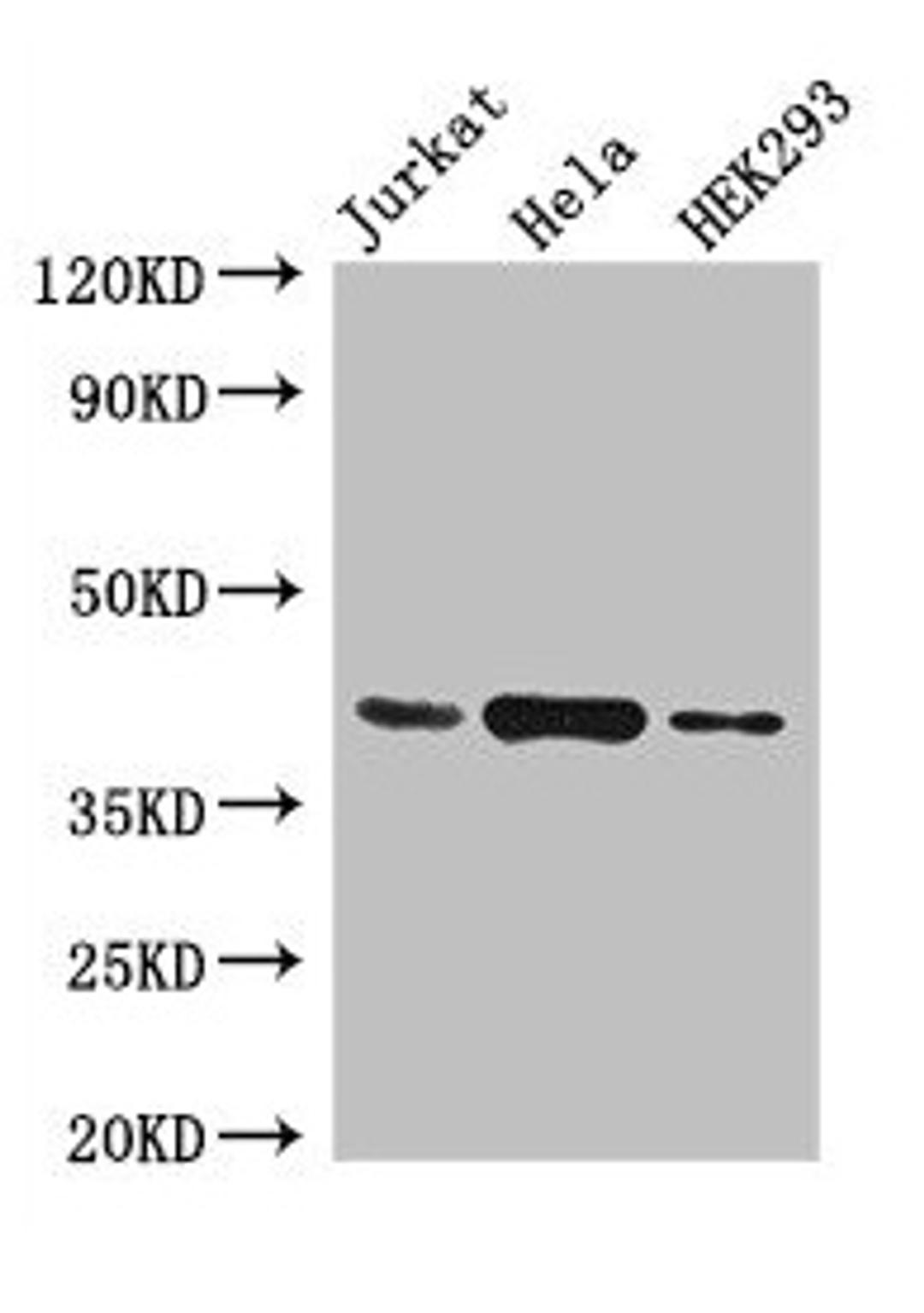 Western Blot. Positive WB detected in: Jurkat whole cell lysate, Hela whole cell lysate, HEK293 whole cell lysate. All lanes: HLA-C antibody at 4µg/ml. Secondary. Goat polyclonal to rabbit IgG at 1/50000 dilution. Predicted band size: 41 kDa. Observed band size: 41 kDa