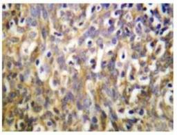 Immunohistochemistry-Paraffin: MMP10 Antibody [NB100-92182] - Immunohistochemistry (IHC) analysis of MMP-10 (I387) pAb in paraffin-embedded human brain tissue.