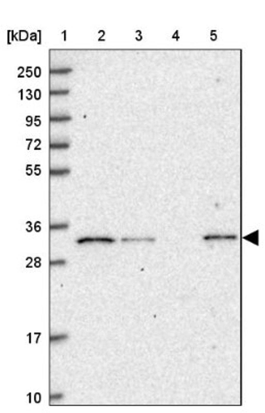 Western Blot: PSMA1 Antibody [NBP2-37908] - Lane 1: Marker [kDa] 250, 130, 95, 72, 55, 36, 28, 17, 10<br/>Lane 2: RT-4<br/>Lane 3: U-251 MG<br/>Lane 4: Human Plasma<br/>Lane 5: Liver