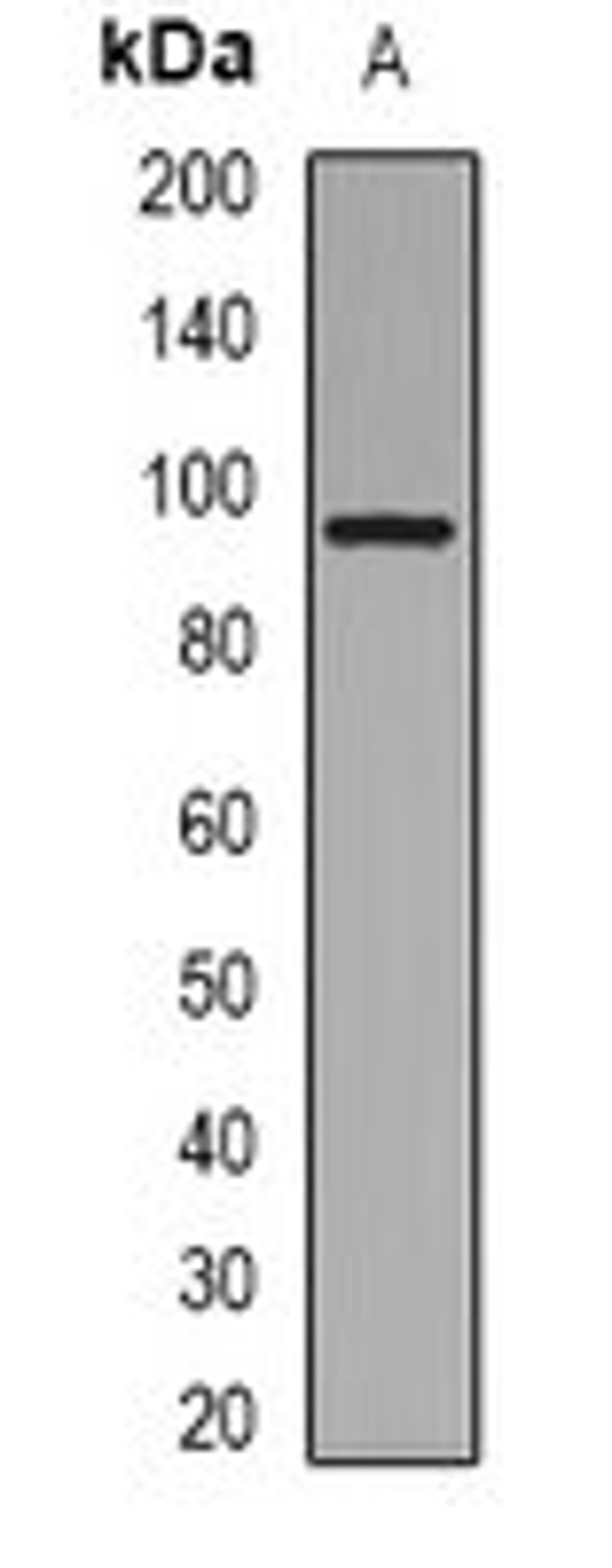 Western blot analysis of Jurkat (Lane 1) whole cell lysates using Collagen 1 alpha 2 antibody