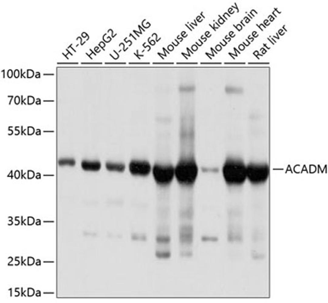 Western blot - ACADM antibody (A1873)