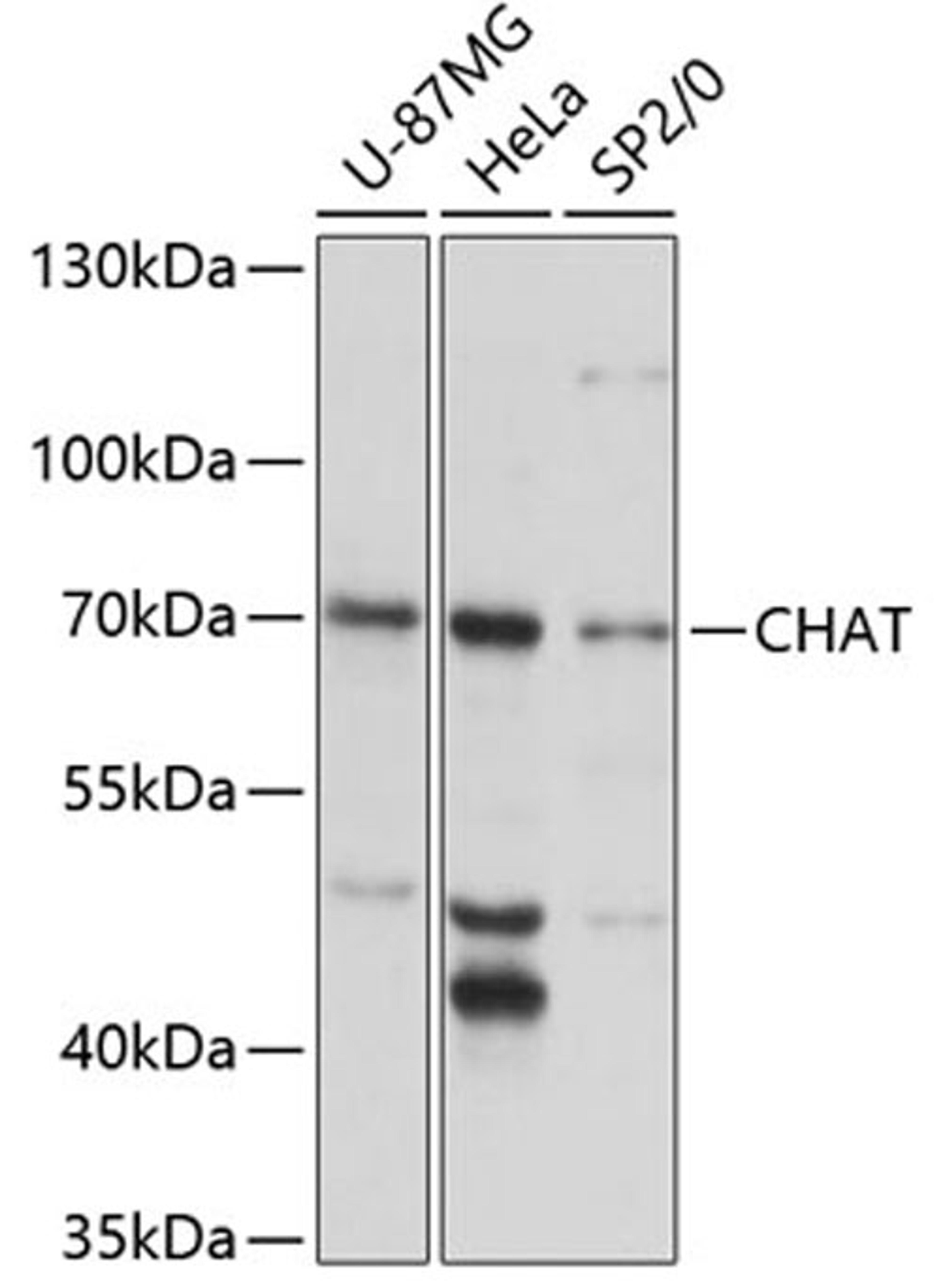 Western blot - CHAT antibody (A13244)