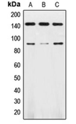 Western blot analysis of HL60 (Lane 1), SKNSH (Lane 2), mouse brain (Lane 3) whole cell lysates using TrkB antibody