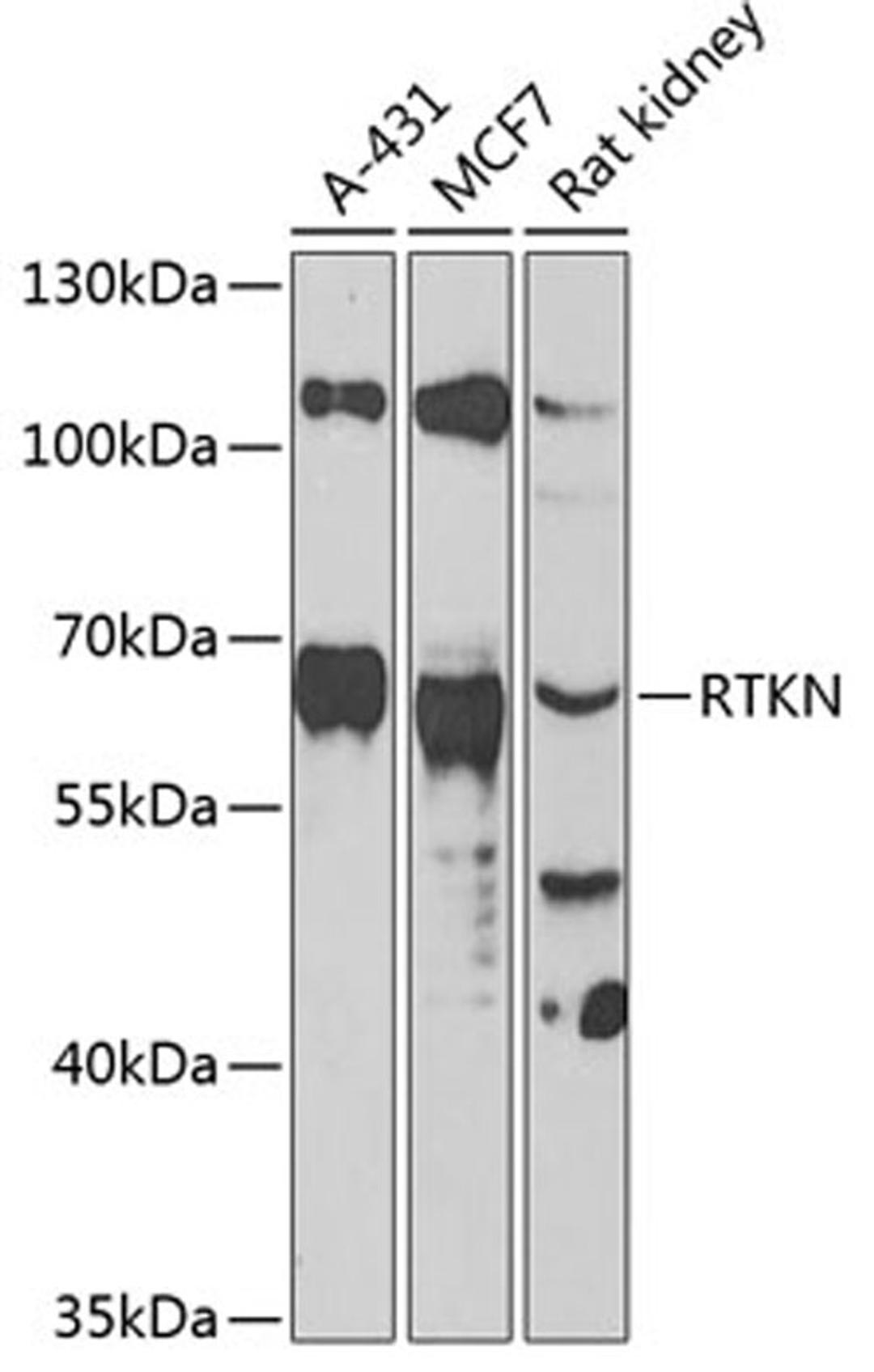 Western blot - RTKN antibody (A13349)