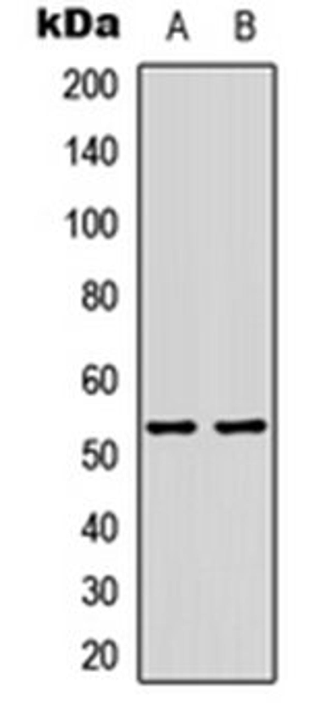 Western blot analysis of HepG2 (Lane 1), H9C2 (Lane 2) whole cell lysates using p53 (AcK386) antibody