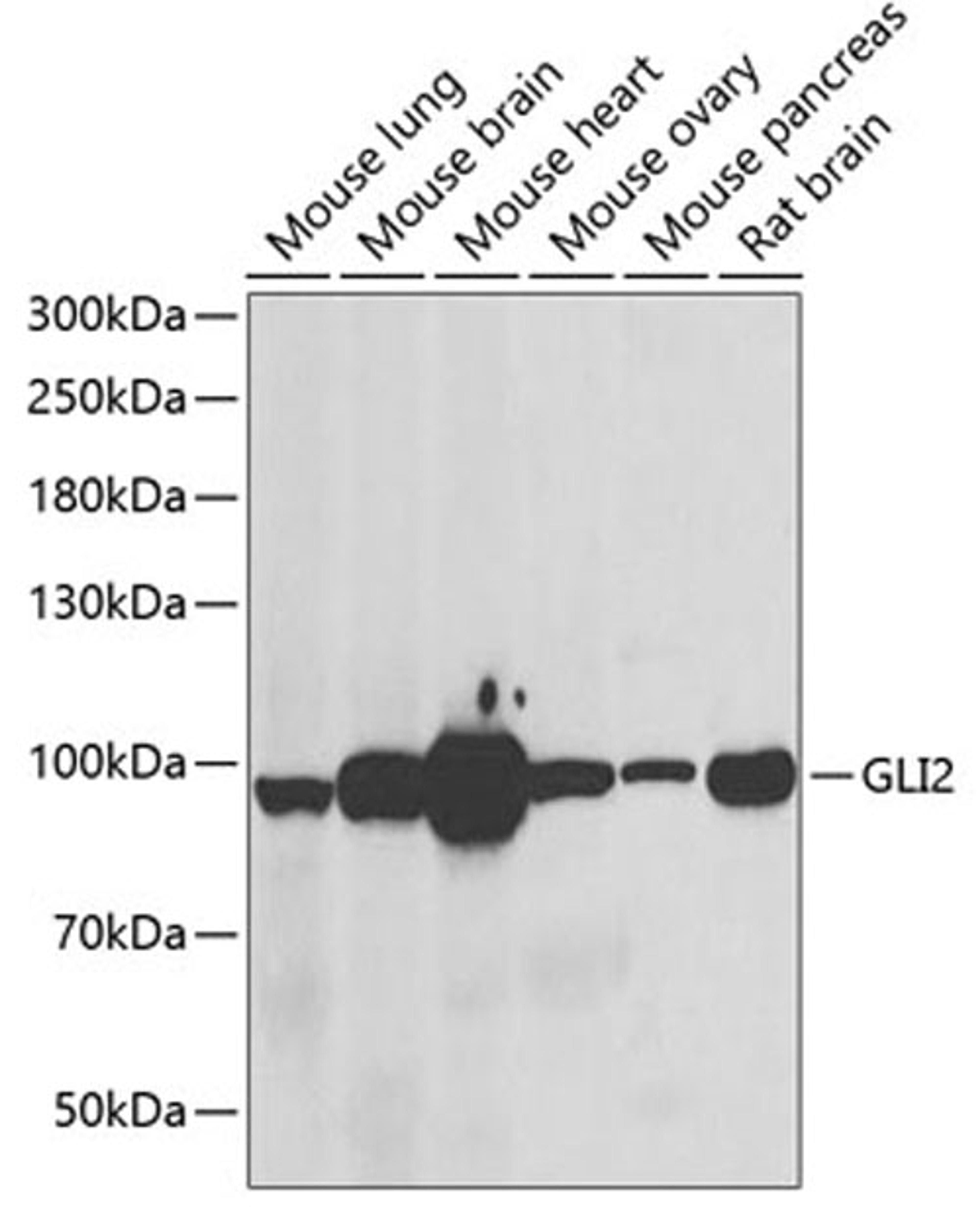 Western blot - GLI2 antibody (A6510)