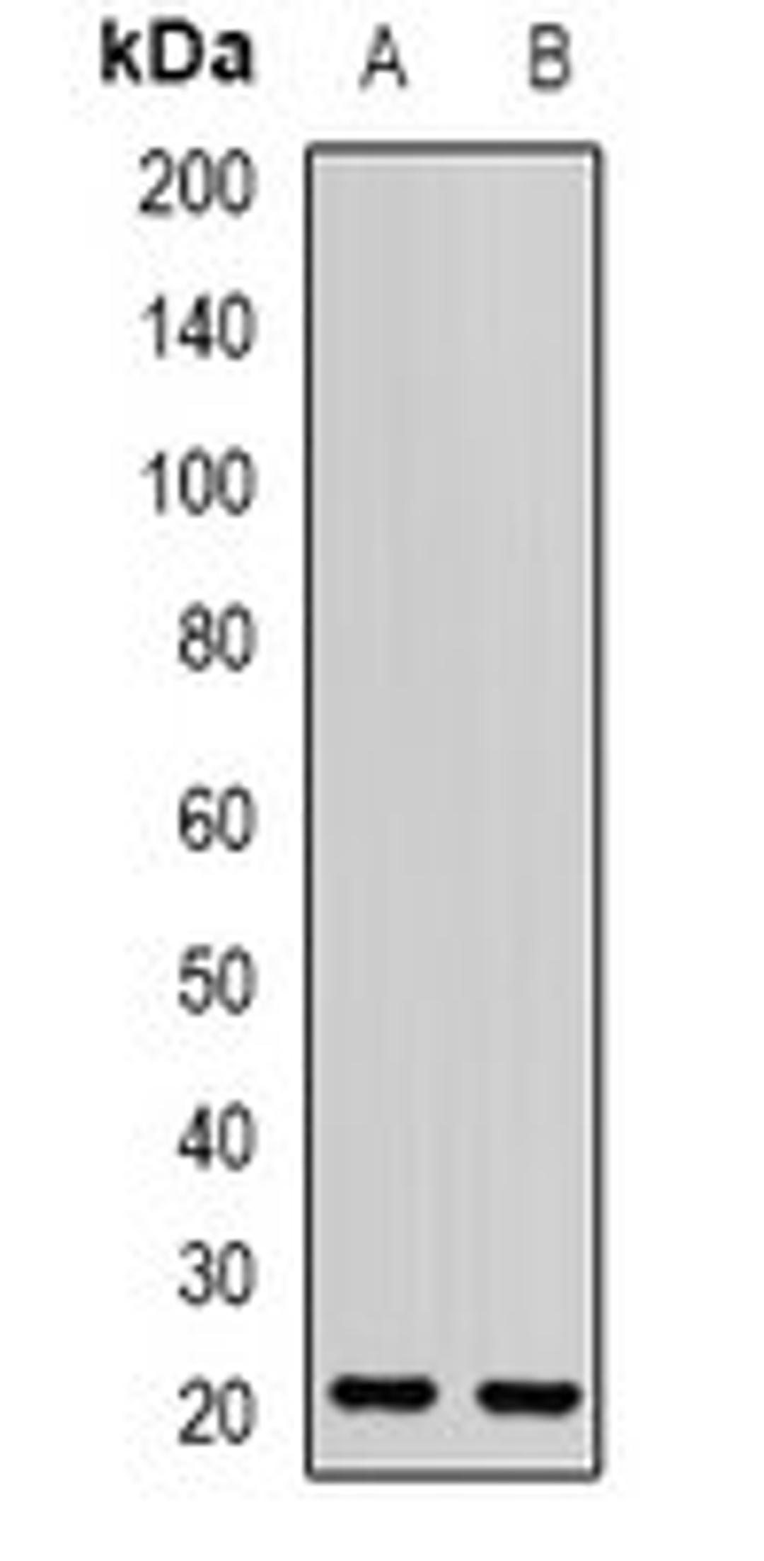 Western blot analysis of mouse eye (Lane1), rat eye (Lane2) whole cell lysates using OPA3 antibody