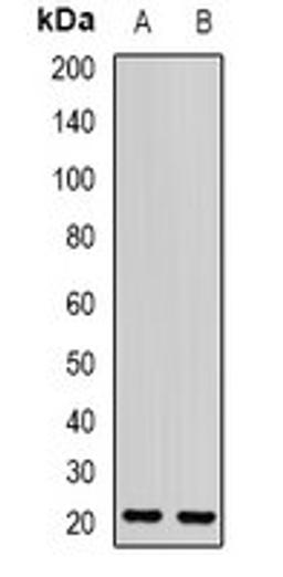 Western blot analysis of mouse eye (Lane1), rat eye (Lane2) whole cell lysates using OPA3 antibody