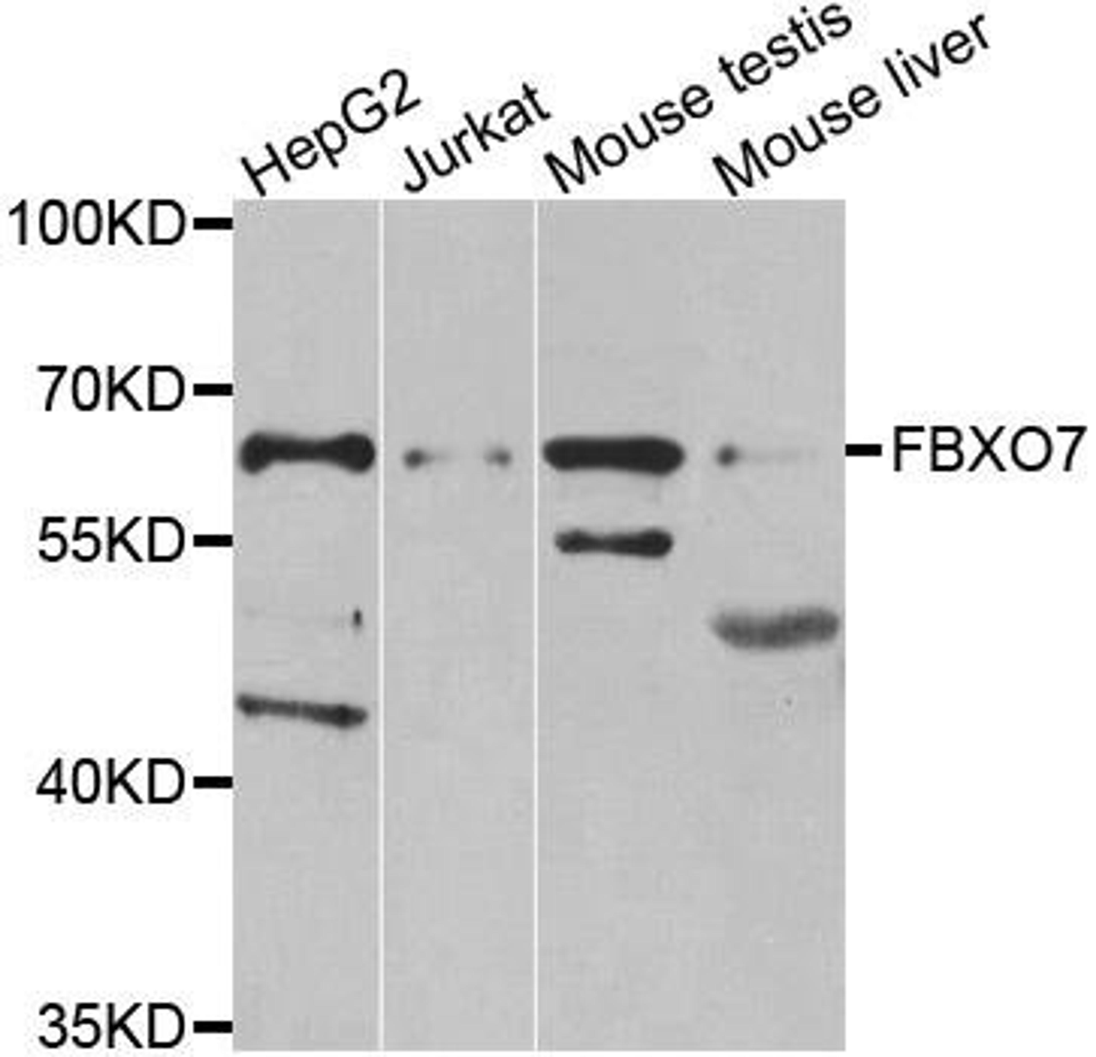 Western blot analysis of extracts of various cell lines using FBXO7 antibody