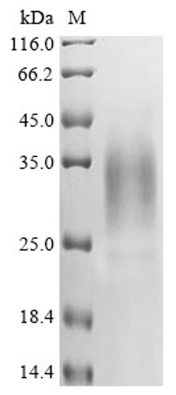 (Tris-Glycine gel) Discontinuous SDS-PAGE (reduced) with 5% enrichment gel and 15% separation gel.