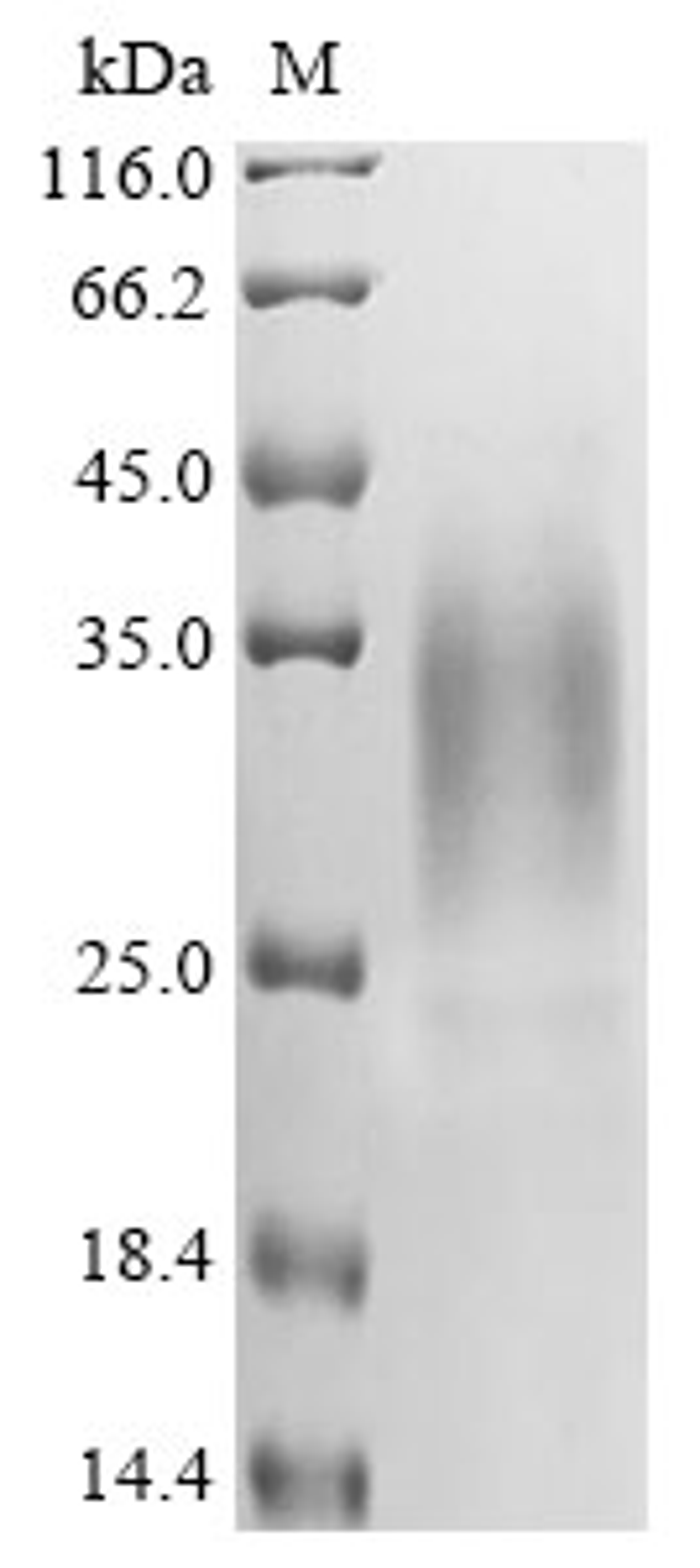 (Tris-Glycine gel) Discontinuous SDS-PAGE (reduced) with 5% enrichment gel and 15% separation gel.