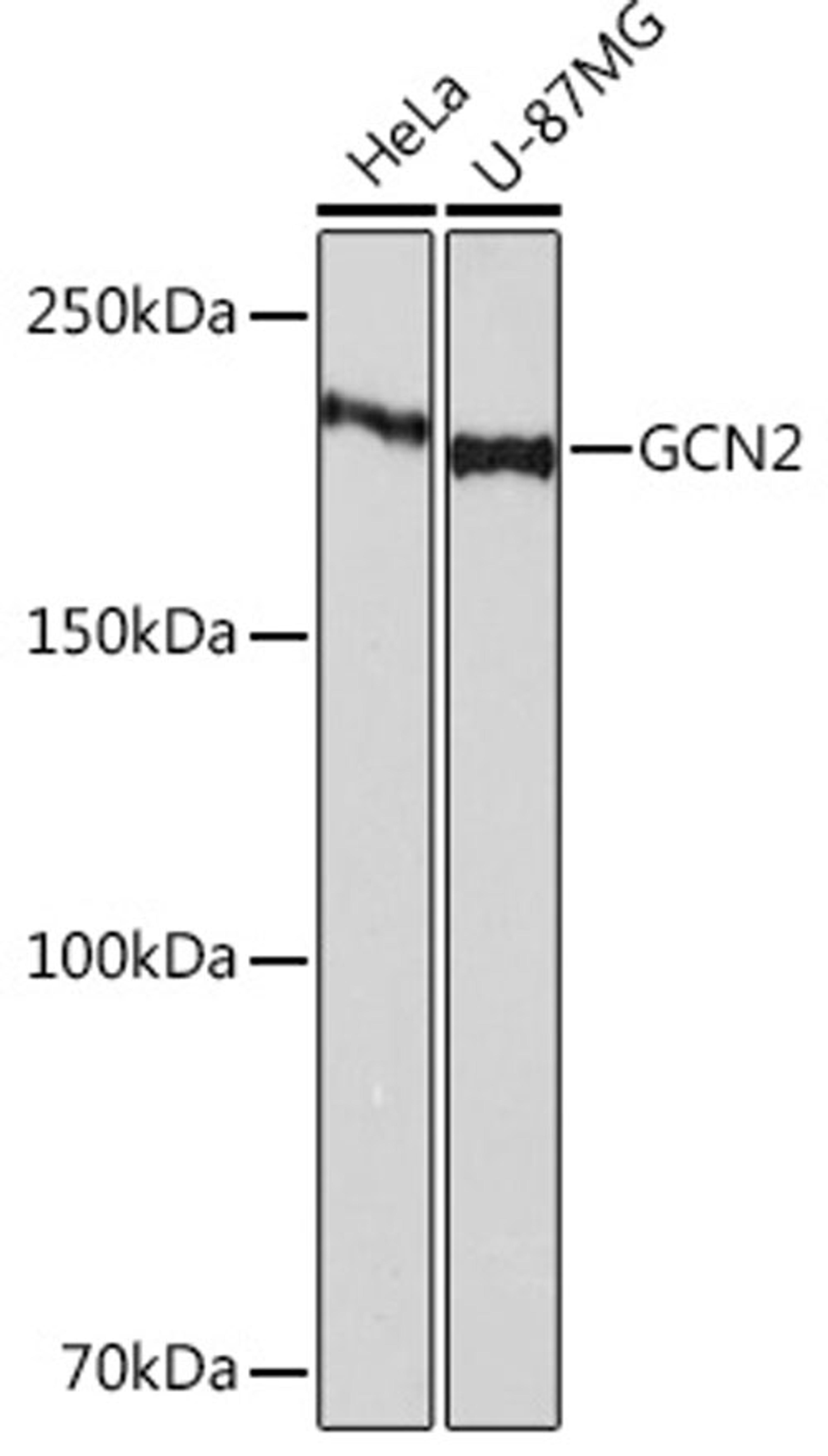 Western blot - GCN2 Rabbit mAb (A2307)