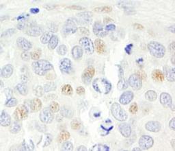 Detection of human p14ARF by immunohistochemistry.