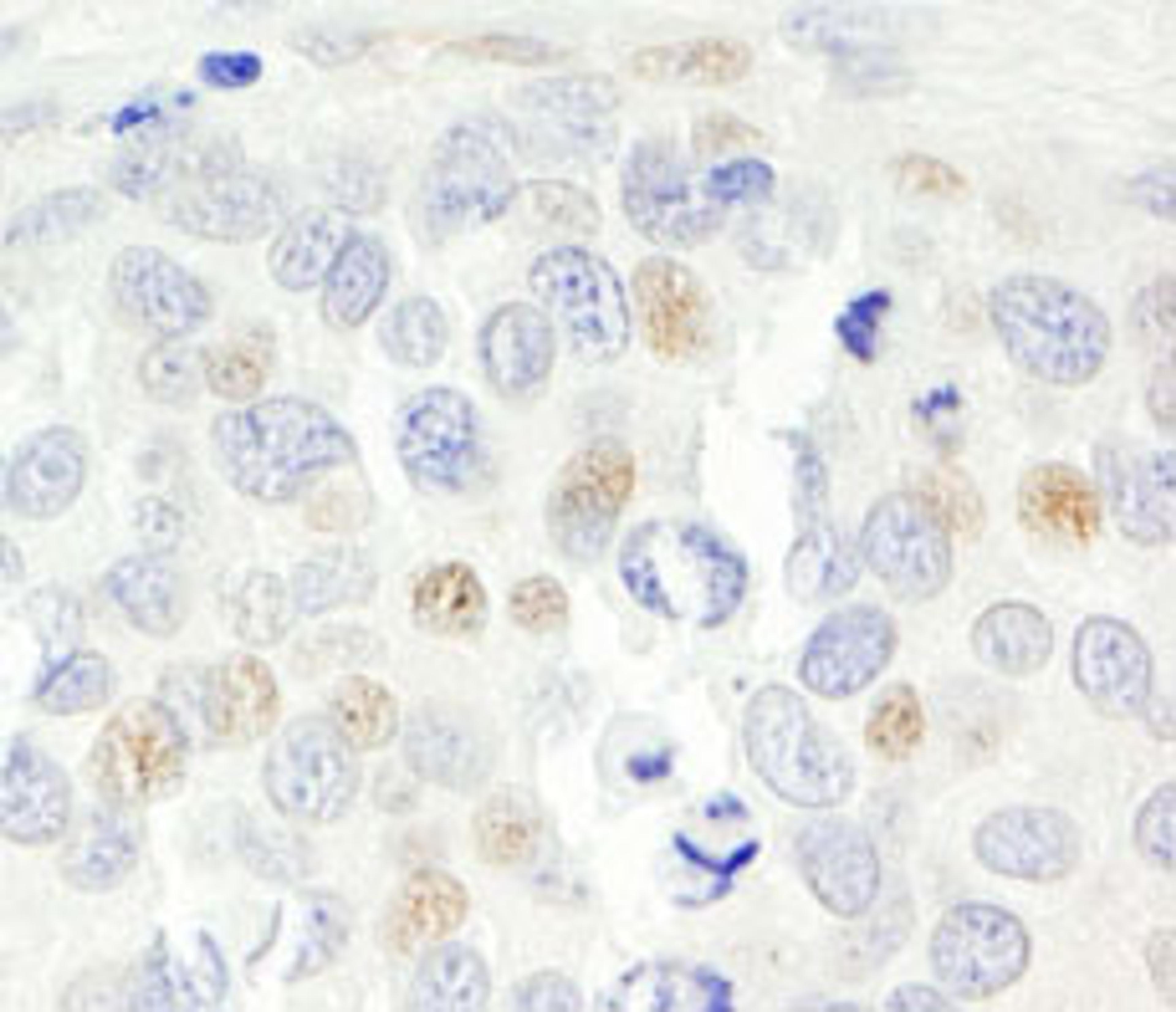 Detection of human p14ARF by immunohistochemistry.