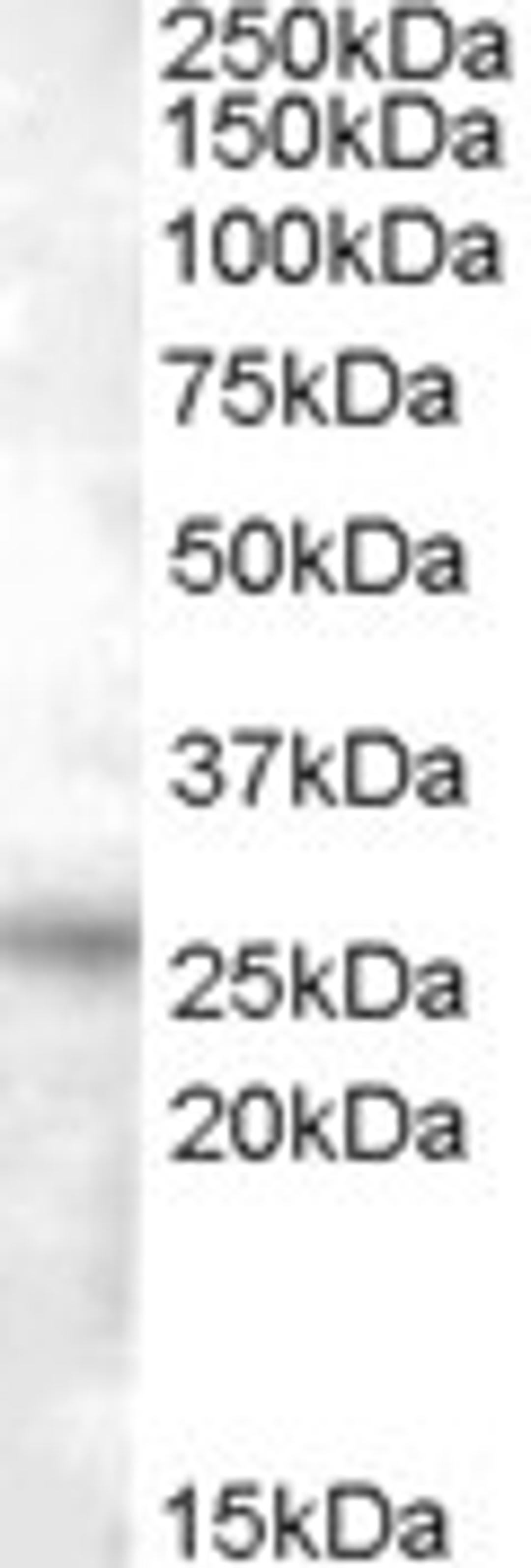 46-891 (0.5ug/ml) staining of Heart lysate (35ug protein in RIPA buffer) with (B) and without (A) blocking with the immunising peptide. Primary incubation was 1 hour. Detected by chemiluminescence.