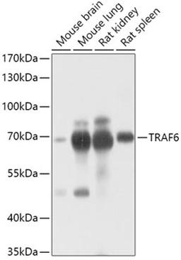 Western blot - TRAF6 antibody (A16991)