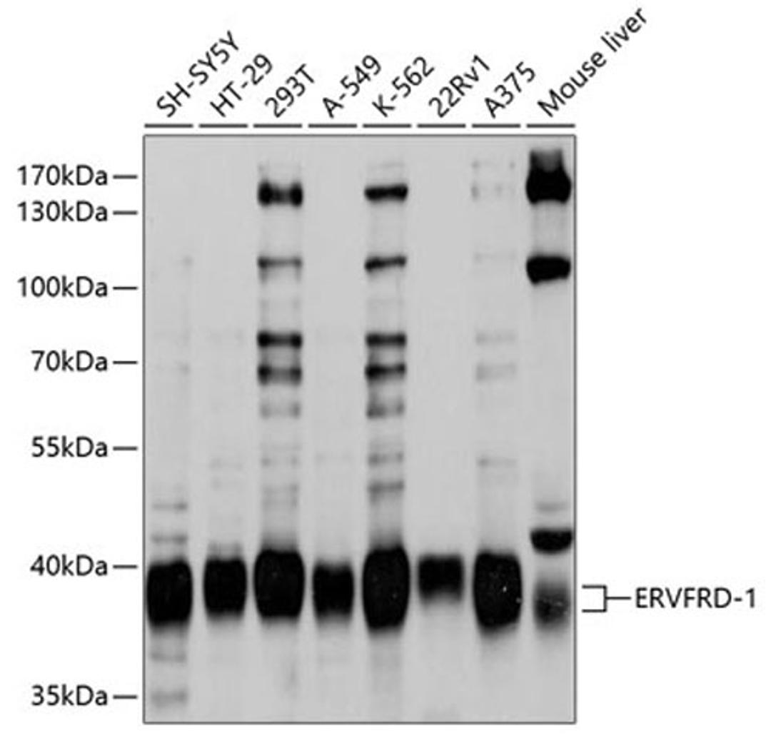 Western blot - ERVFRD-1 antibody (A10162)