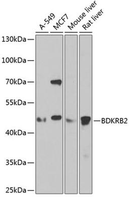 Western blot - BDKRB2 antibody (A2844)