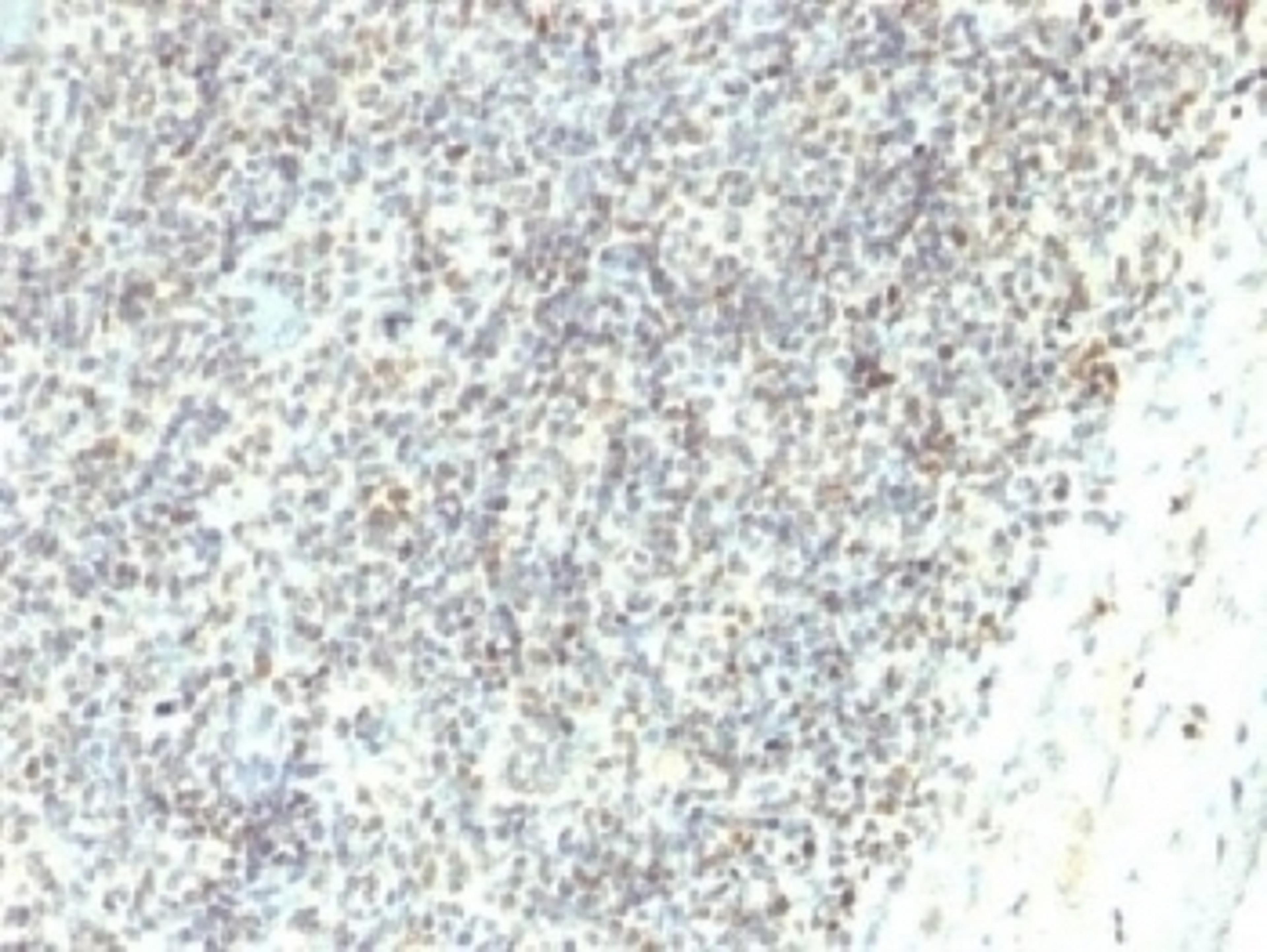 IHC testing of FFPE human spleen with ETS1 antibody (clone ETS1/1282). Required HIER: boil tissue sections in 10mM Tris with 1mM EDTA, pH 9, for 10-20 min followed by cooling at RT for 20 min.