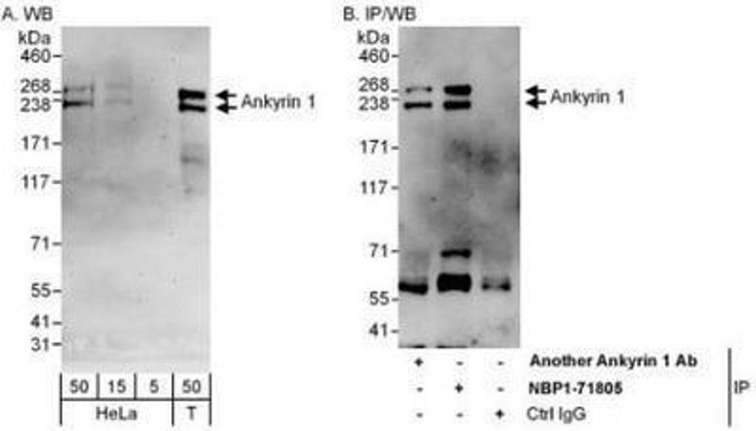 Western Blot: Ankyrin 1 Antibody [NBP1-71805] - Whole cell lysate from HeLa (5, 15 and 50 mcg for WB; 1 mg for IP, 20% of IP loaded) and 293T (T; 50 mcg) cells.  Affinity purified rabbit anti-Ankyrin 1 antibody used for WB at 0.4 mcg/ml (A) and 1 mcg/ml (B) and used for IP at 6 mcg/mg lysate.  Ankyrin 1 was also immunoprecipitated by another rabbit anti-Ankyrin 1 antibody, which recognizes an upstream epitope.