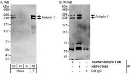 Western Blot: Ankyrin 1 Antibody [NBP1-71805] - Whole cell lysate from HeLa (5, 15 and 50 mcg for WB; 1 mg for IP, 20% of IP loaded) and 293T (T; 50 mcg) cells.  Affinity purified rabbit anti-Ankyrin 1 antibody used for WB at 0.4 mcg/ml (A) and 1 mcg/ml (B) and used for IP at 6 mcg/mg lysate.  Ankyrin 1 was also immunoprecipitated by another rabbit anti-Ankyrin 1 antibody, which recognizes an upstream epitope.