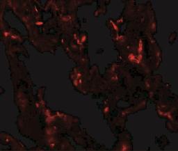 Immunocytochemistry/Immunofluorescence: TTF1 / NKX2.1 Antibody [NBP2-41160] - Immunofluorescence of NKX2-1 in human lung tissue with NKX2-1 antibody at 20 ug/mL.