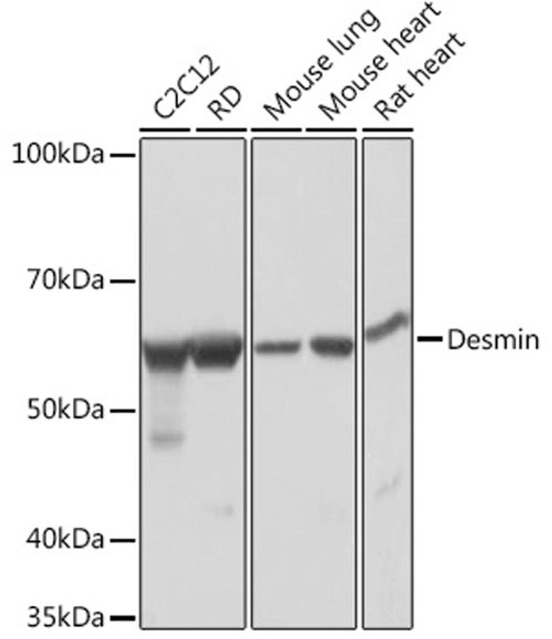 Western blot - Desmin Rabbit mAb (A3736)