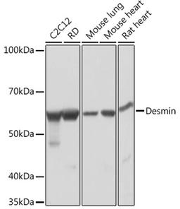 Western blot - Desmin Rabbit mAb (A3736)