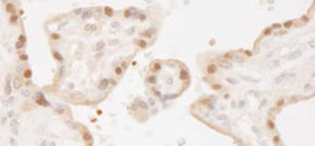 Detection of human MST1 and MST2 by immunohistochemistry.