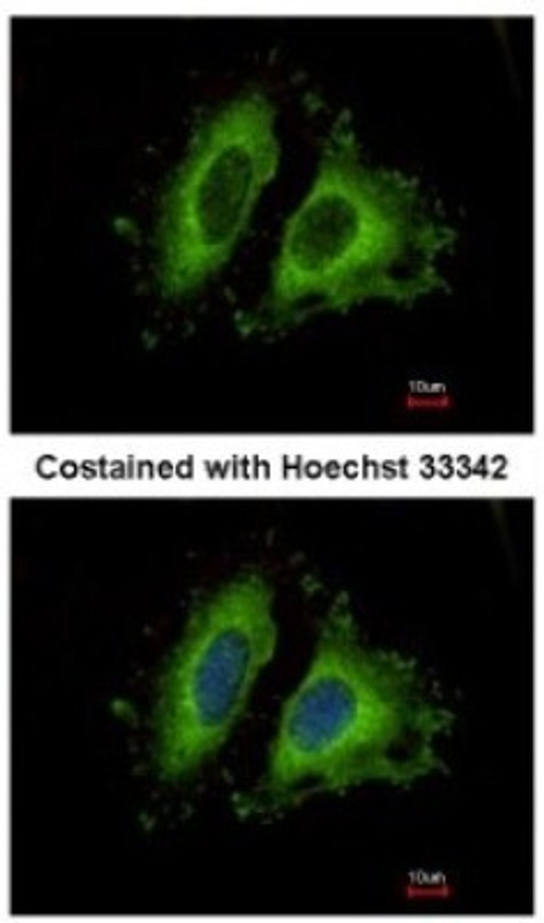 Immunocytochemistry/Immunofluorescence: GIT1 Antibody [NBP1-31447] - Analysis of methanol-fixed HeLa, using antibody at 1:500 dilution.