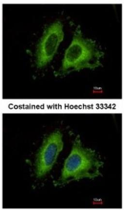 Immunocytochemistry/Immunofluorescence: GIT1 Antibody [NBP1-31447] - Analysis of methanol-fixed HeLa, using antibody at 1:500 dilution.