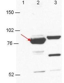 Western blot analysis of 293T cell extracts. Lane 1: GFP-transfected. Lane 2: Esrp-1 transfected (arrow). Lane 3: Esrp-2 transfected using Esrp-1/2 antibody