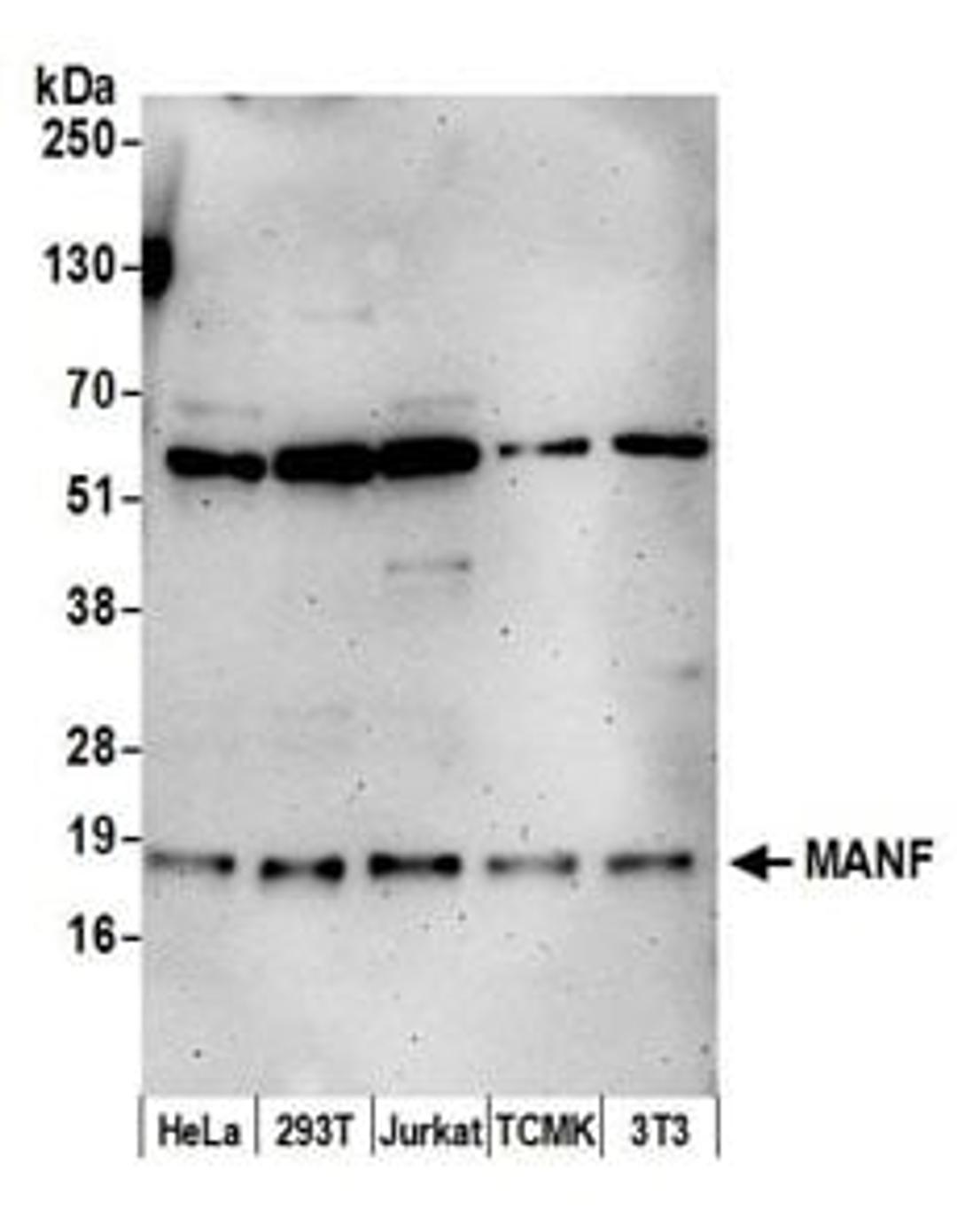 Detection of human and mouse MANF by western blot.