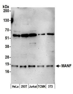 Detection of human and mouse MANF by western blot.