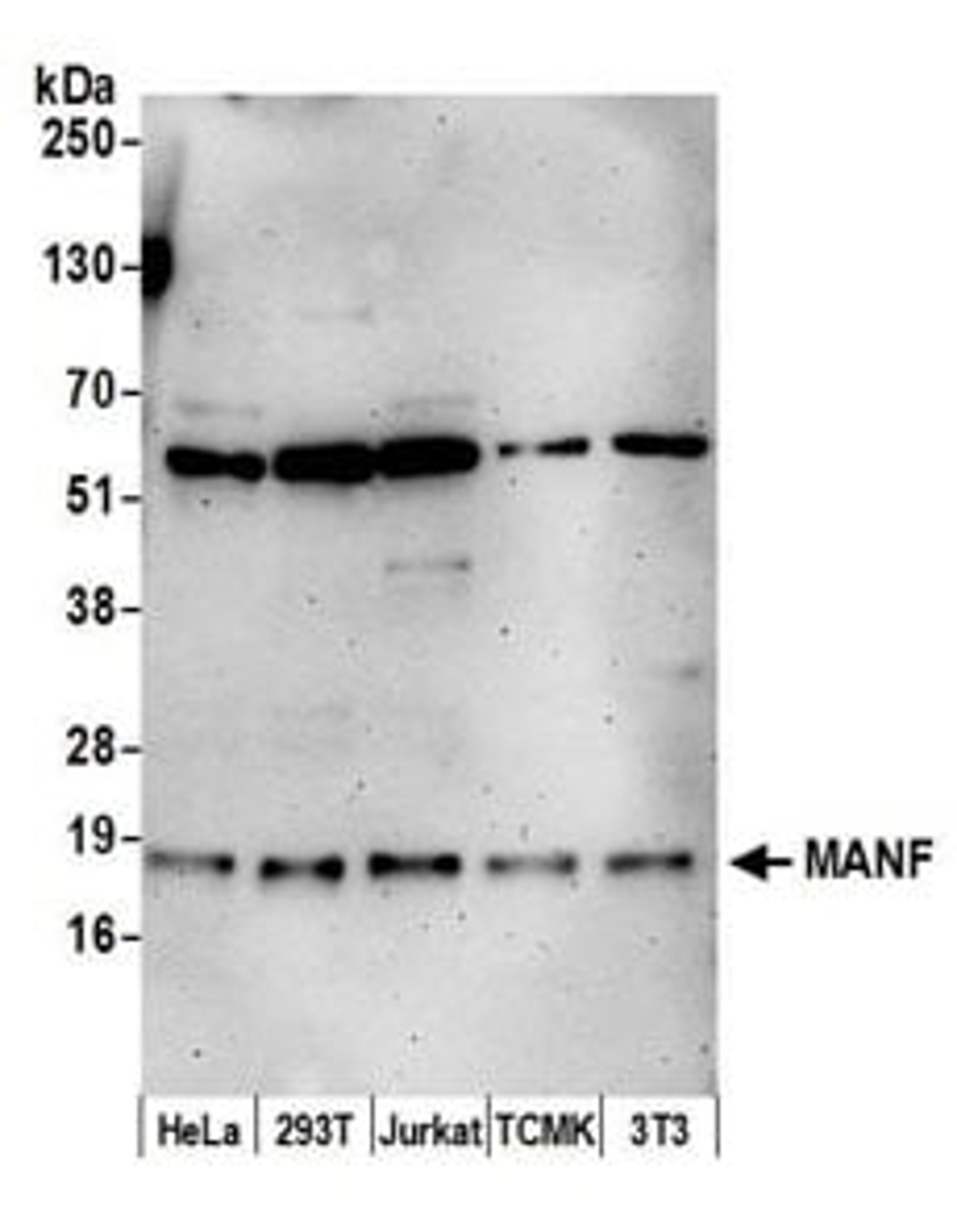 Detection of human and mouse MANF by western blot.