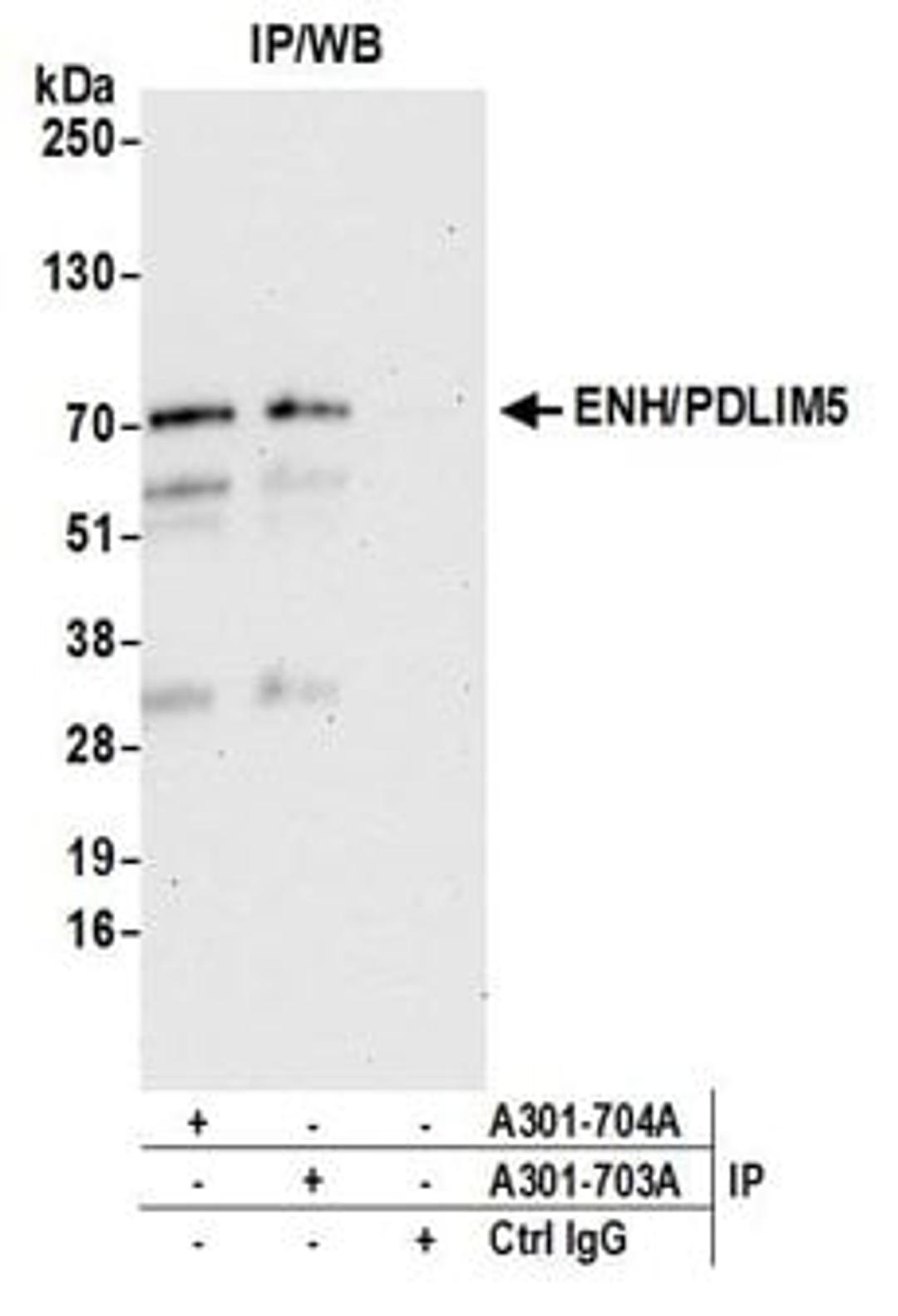 Detection of human ENH/PDLIM5 by western blot of immunoprecipitates.