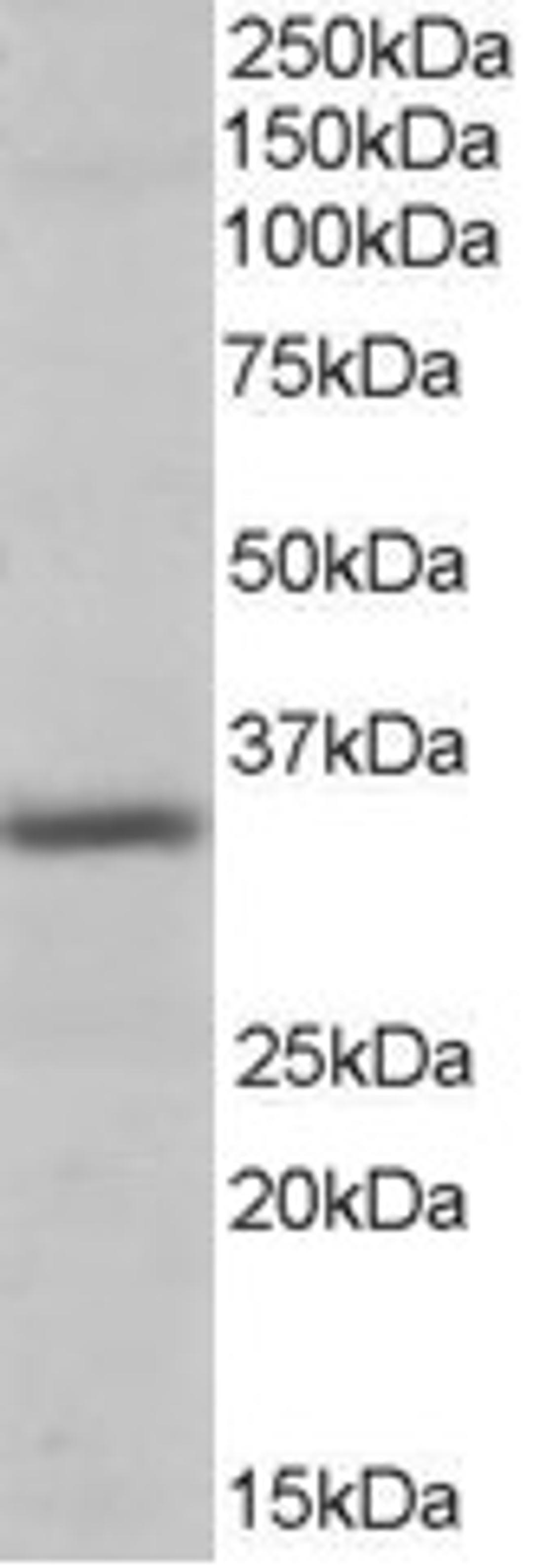 46-193 (0.3ug/ml) staining of Human Heart lysate (35ug protein in RIPA buffer). Primary incubation was 1 hour. Detected by chemiluminescence.