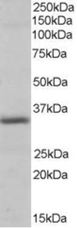 46-193 (0.3ug/ml) staining of Human Heart lysate (35ug protein in RIPA buffer). Primary incubation was 1 hour. Detected by chemiluminescence.