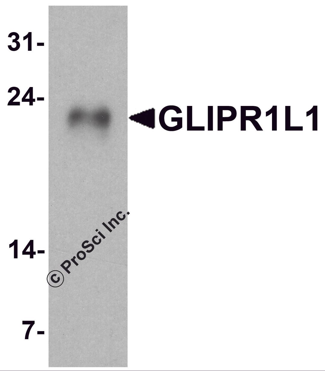 Western blot analysis of GLIPR1L1 in human testis tissue lysate with GLIPR1L1 antibody at 1 μg/ml.
