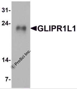 Western blot analysis of GLIPR1L1 in human testis tissue lysate with GLIPR1L1 antibody at 1 μg/ml.