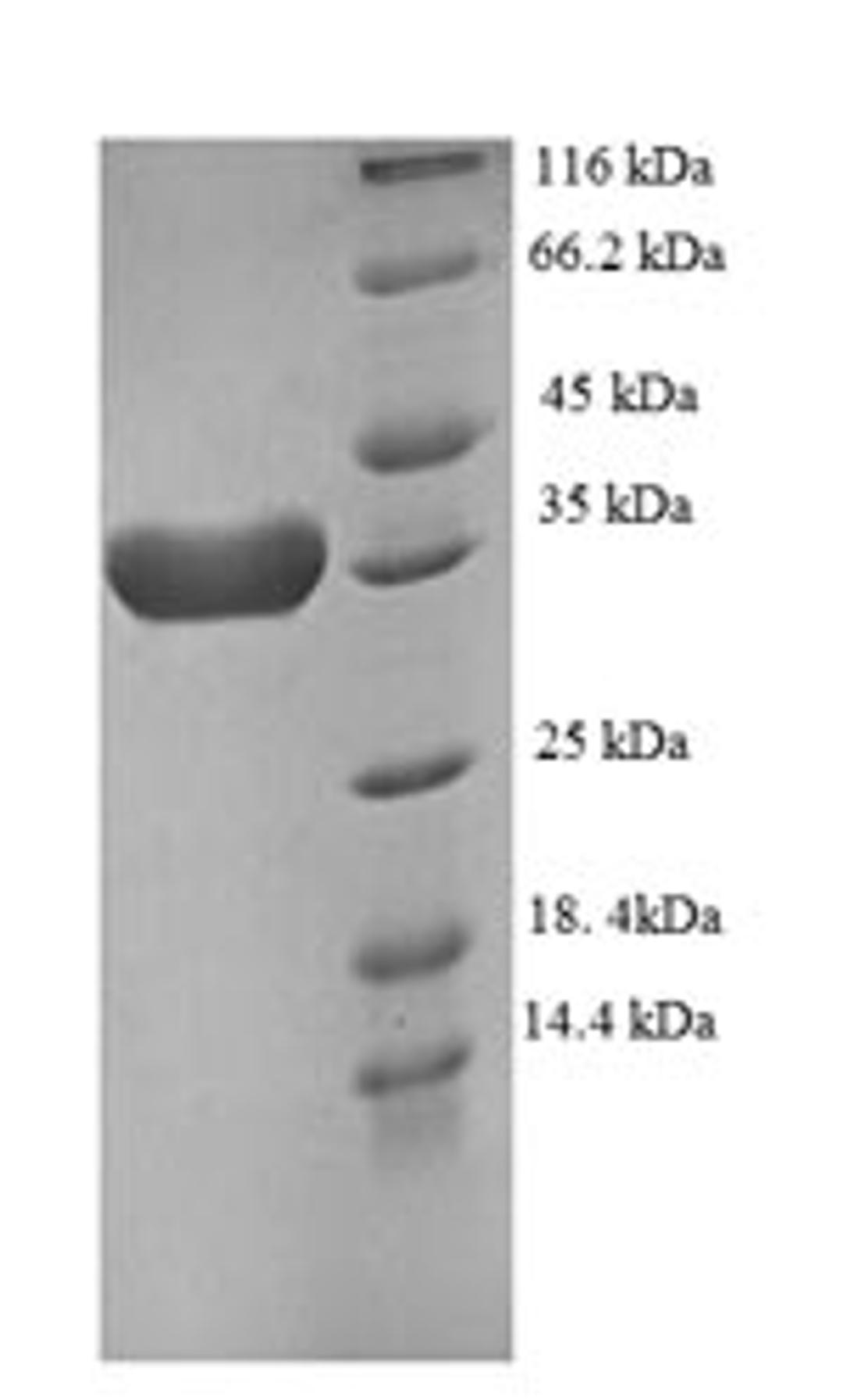 (Tris-Glycine gel) Discontinuous SDS-PAGE (reduced) with 5% enrichment gel and 15% separation gel.