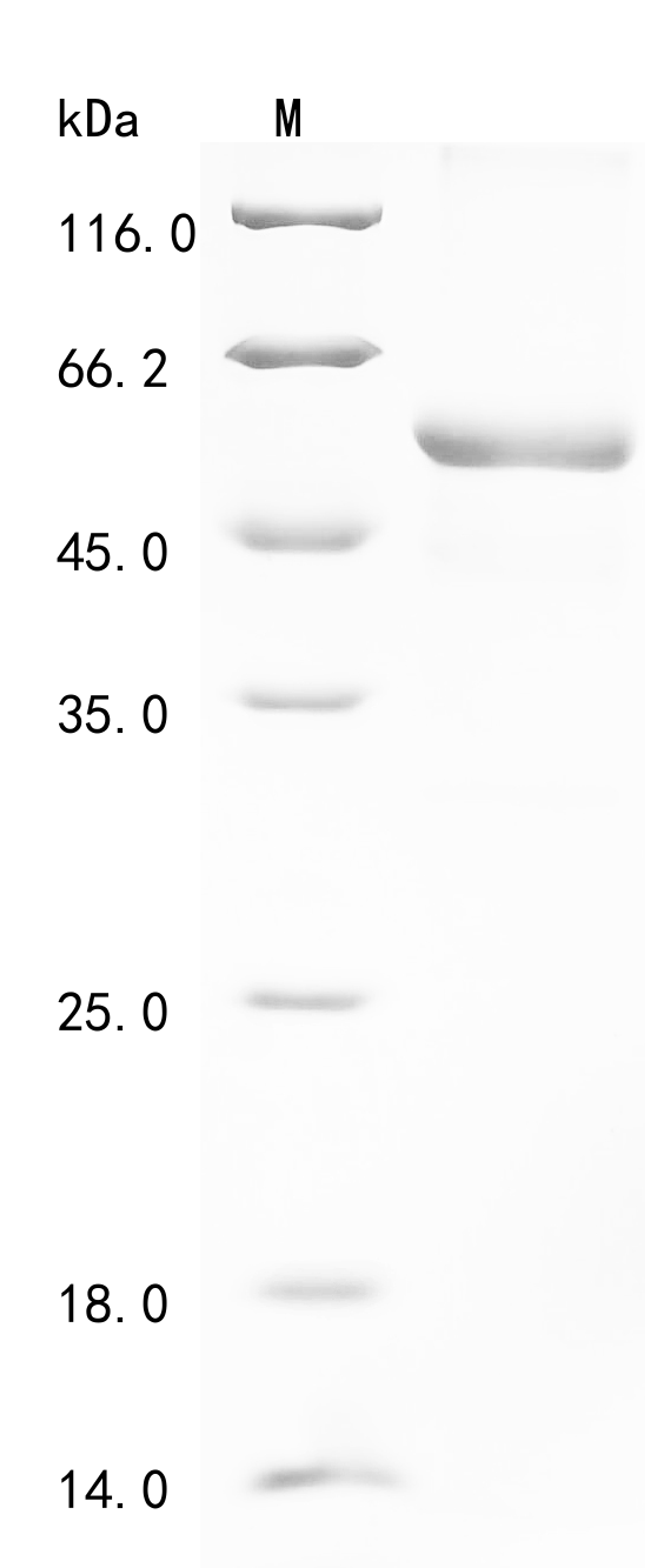 (Tris-Glycine gel) Discontinuous SDS-PAGE (reduced) with 5% enrichment gel and 15% separation gel.