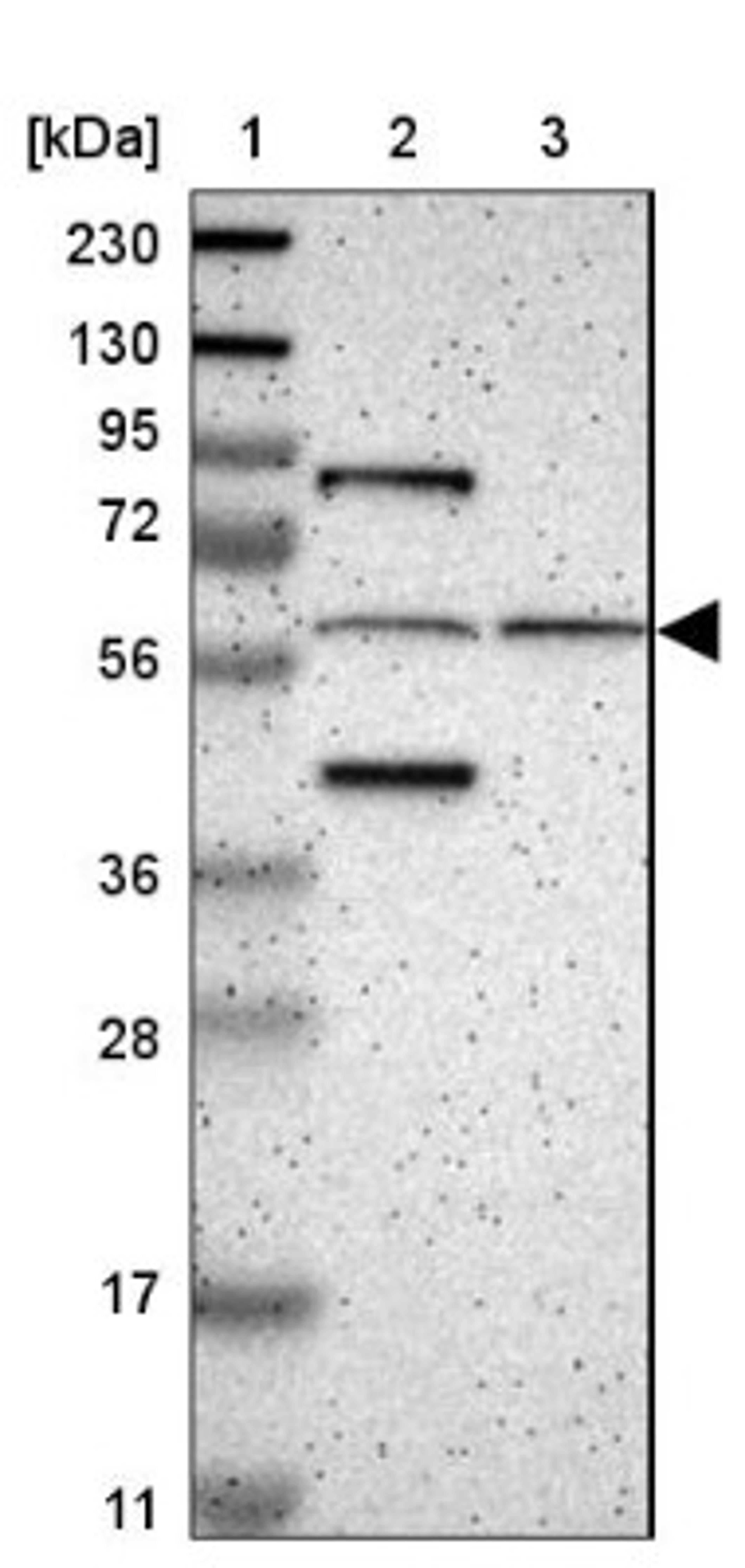 Western Blot: SARG Antibody [NBP1-83487] - Lane 1: Marker [kDa] 230, 130, 95, 72, 56, 36, 28, 17, 11<br/>Lane 2: Human cell line RT-4<br/>Lane 3: Human cell line U-251MG sp