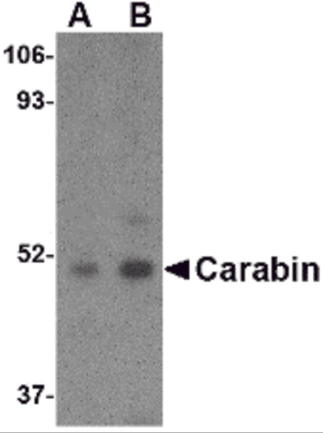 Western blot analysis of Carabin in Daudi cell lysate with Carabin antibody at (A) 1 and (B) 2 μg/mL.
