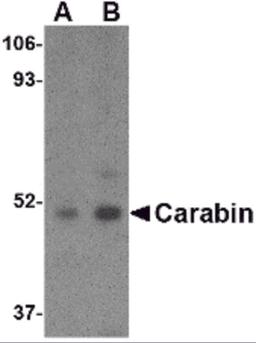 Western blot analysis of Carabin in Daudi cell lysate with Carabin antibody at (A) 1 and (B) 2 μg/mL.